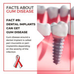 Gum Disease Fact