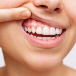 Patient looking at her gums